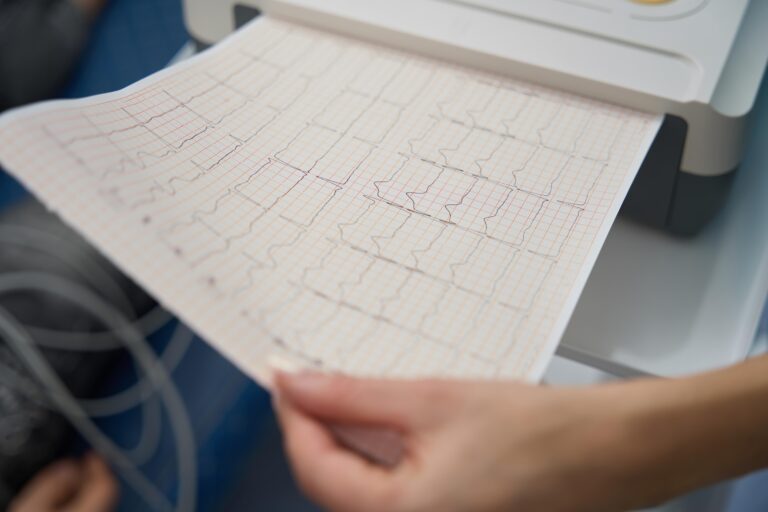 atrial fibrillation concierge medical care