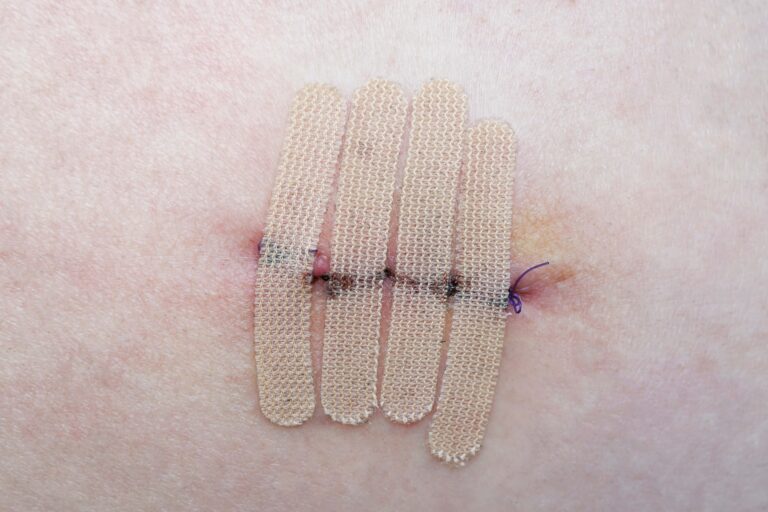 wound care management concierge medicine